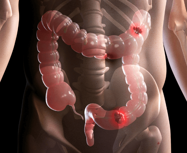 clinical_trial_screening